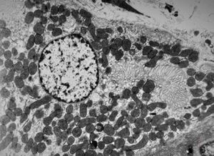 normal mucosa - stomach - parietal cell normal mucosa - stomach - parietal cell